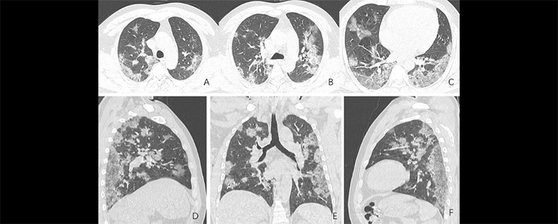 RSNA2.jpg